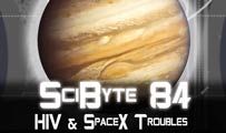 HIV & SpaceX Troubles | SciByte 84