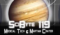 Medical Tech & Martian Crater | SciByte 119