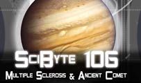 Multiple Sclerosis & Ancient Comet | SciByte 106